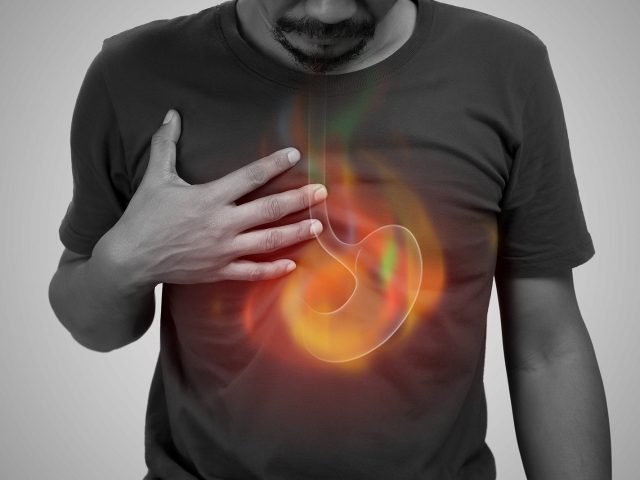 A Man Burning Sensation In The Of The Middle Chest Because Of Ac